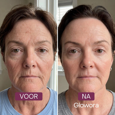 Masque collagen